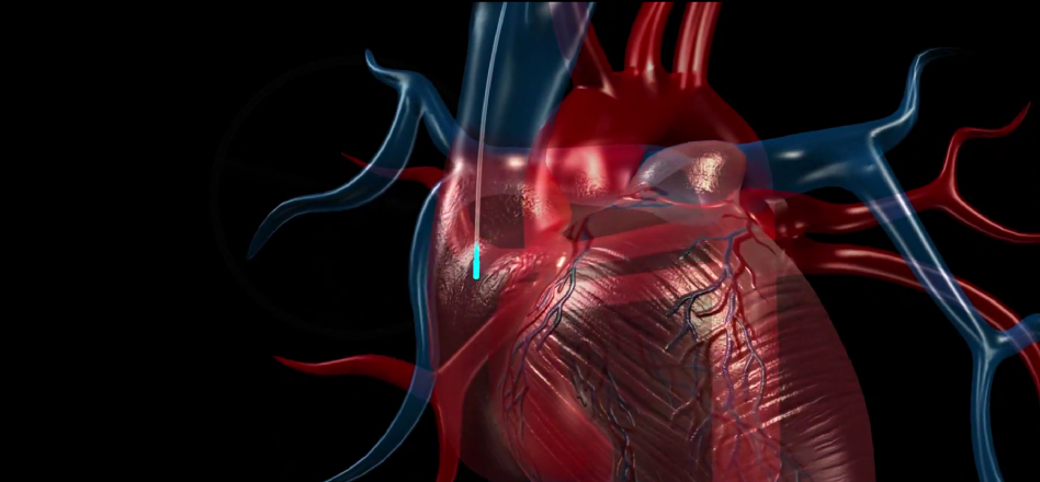 preclincal cardiovascular, cardiovascular, cardiac telemetry equipment