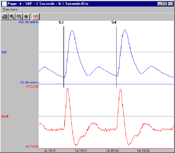 Cardiac Output Chart