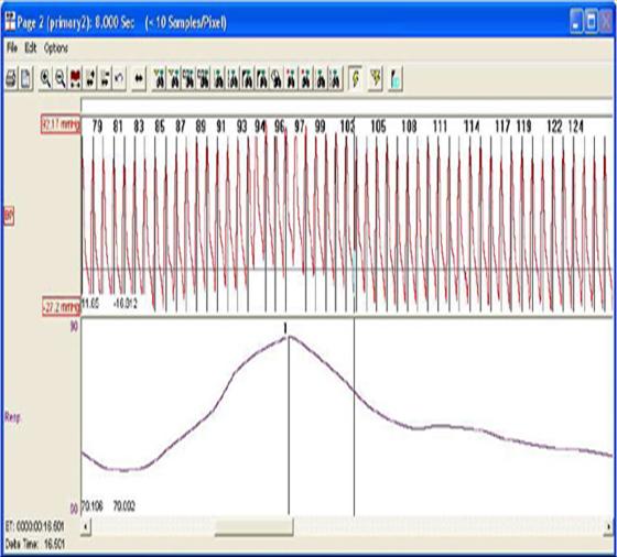 blood pressure software